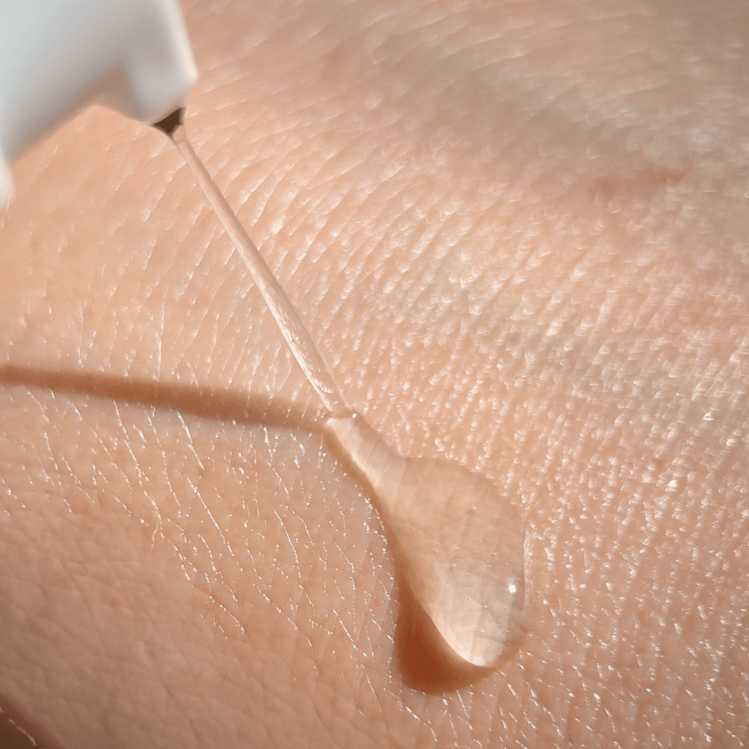 The Skin Barrier, Explained in 500 Words