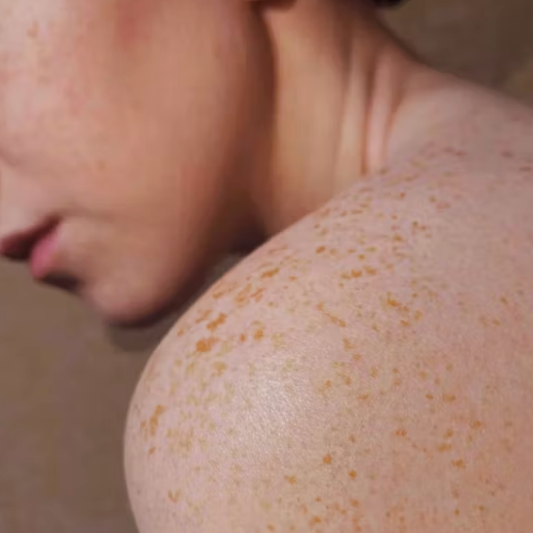 Understanding Skin Barrier, Hydration and Repair: A Formulator's Guide